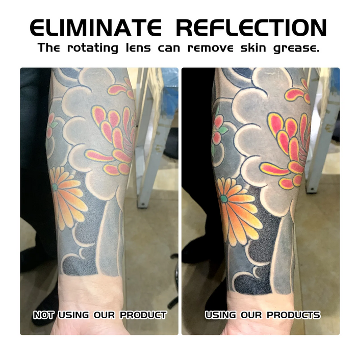 NISIMP Tattoo Photography Artifact Remove Reflection Device